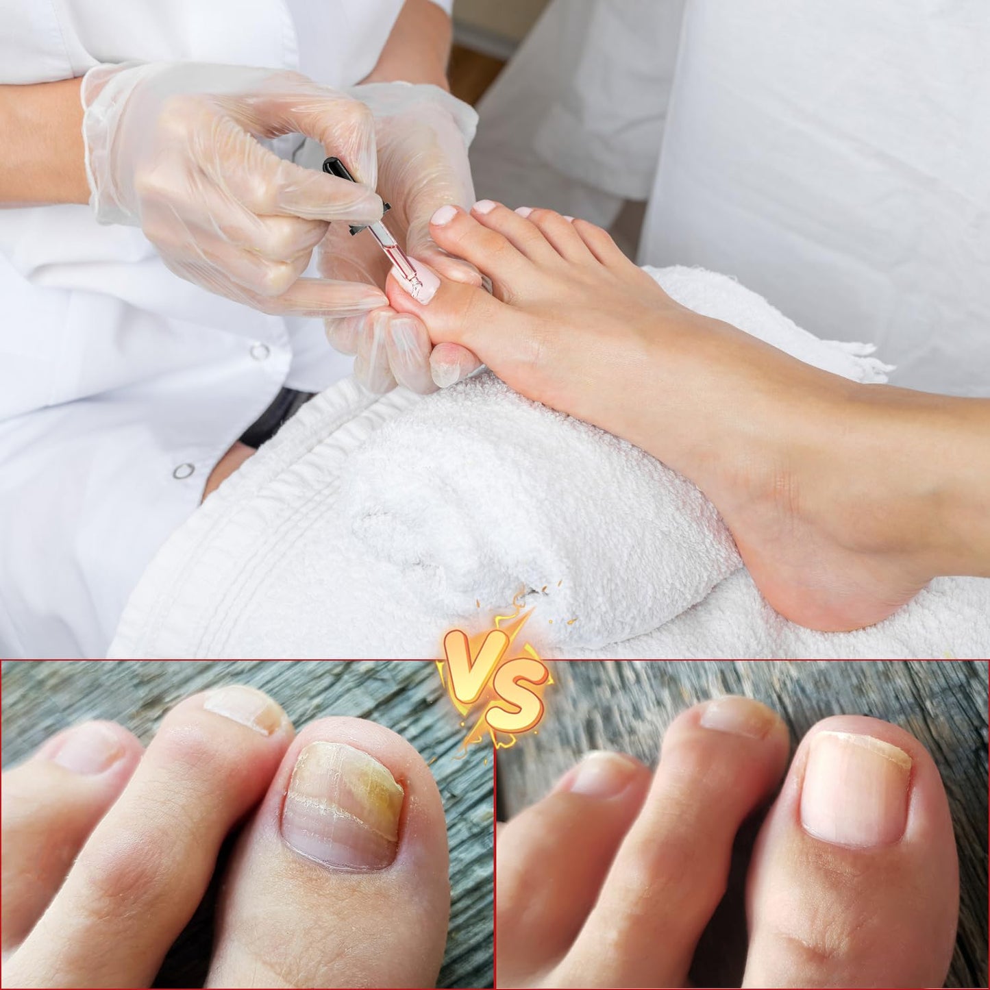 Toenail Drops Herbal Nail Repair Oil