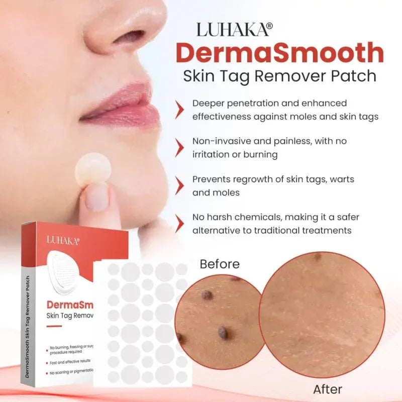 Derma Smooth Skin Tag Removal PatchDERMA SMOOTH SKIN TAG REMOVAL PATCH